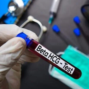 Beta HCG