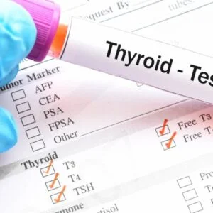 Thyroid Profile (Free)