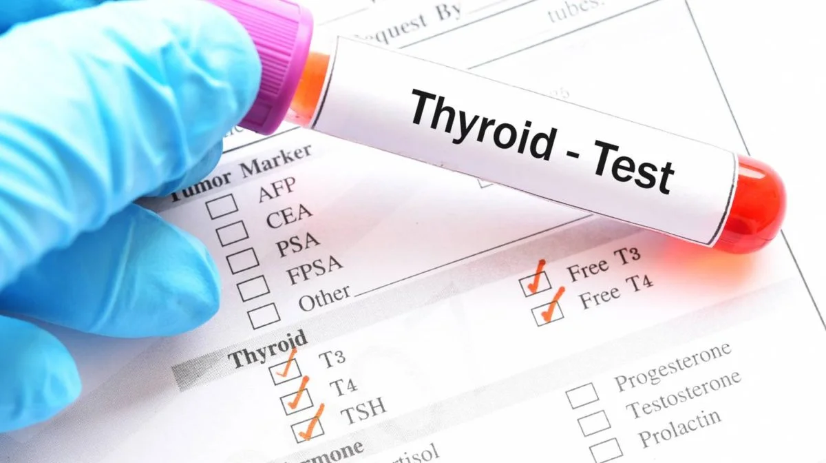 Thyroid Profile (Free)